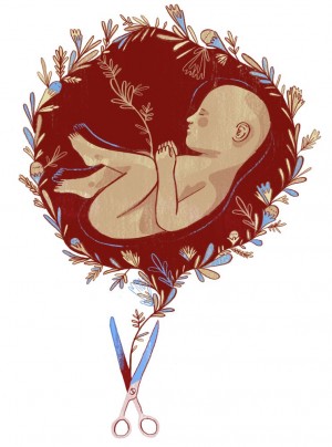 Sobre o aborto pós-nascimento, um eufemismo para infanticídio Sobre o aborto pós-nascimento, um eufemismo para infanticídio