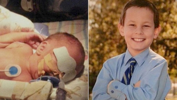 O antes e depois de Dwight, filho de Melissa Gardner (Arquivo pessoal/Facebook)