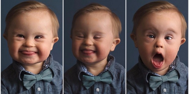 Facebook/Kids With Down Syndrome