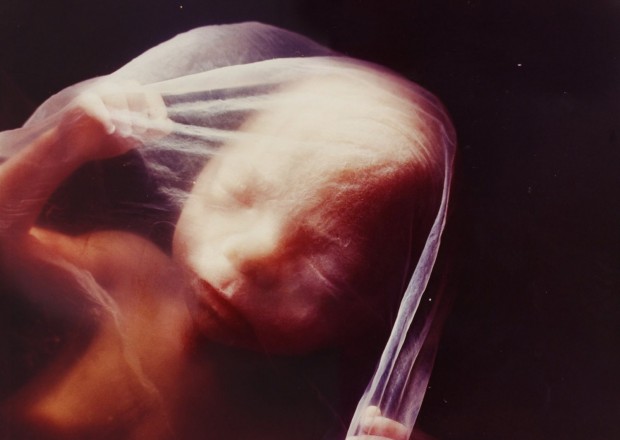 A formação de um bebê no ventre materno em fotos incríveis